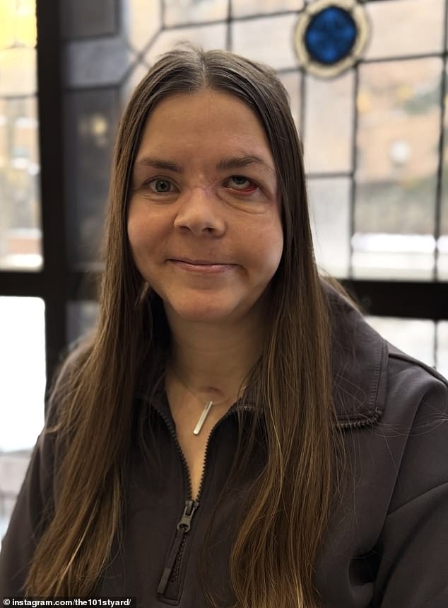 Alaska woman survives brutal grizzly bear attack that caused permanent brain damage