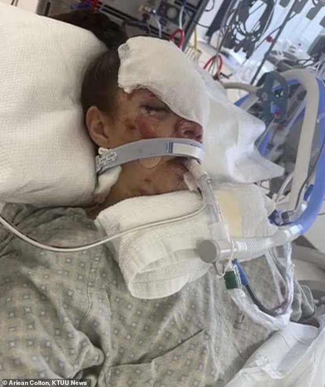 Alaska woman survives brutal grizzly bear attack that caused permanent brain damage