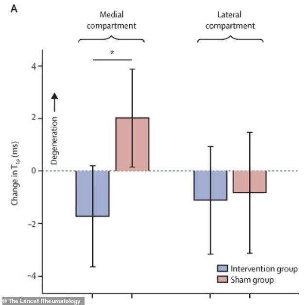 Stanford Study Shows Walking Angle Changes Can Reduce Knee Arthritis Pain