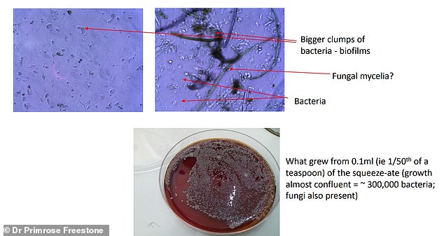 Kitchen sponges shed millions of microplastics onto dishes and into wastewater.