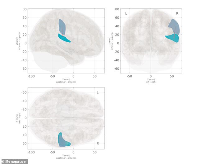 Estrogen drop during menopause rewires brain and raises dementia risk.
