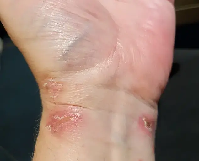 Airbnb horror: British tourist's dream getaway turns into a living nightmare