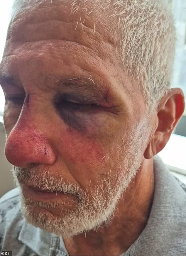 Brazil: Elderly Man Beaten After Confronting Porsche Driver