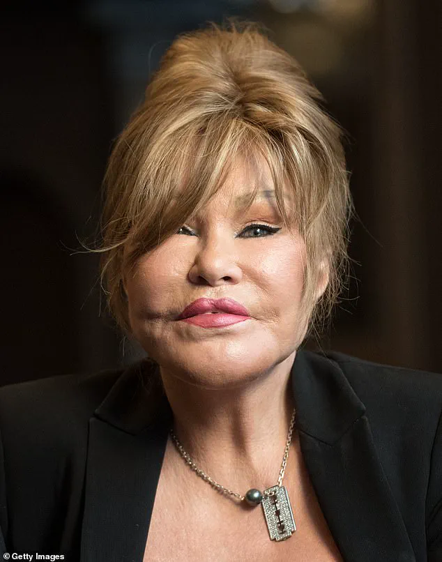 Intimate Photos of Jocelyn Wildenstein Offer Glimpse into Her Life