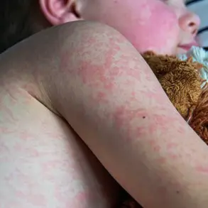 Houston Reports New Measles Case in Infant; Urgent Call for Vaccination Amid Regional Outbreaks