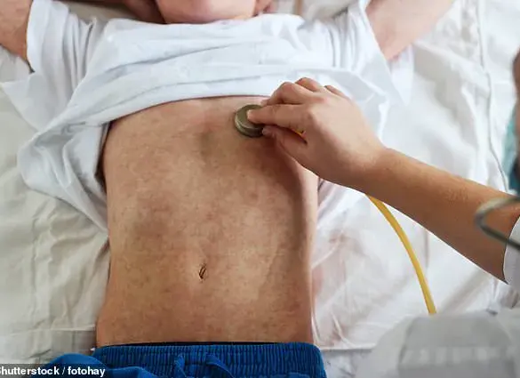 Measles Outbreak in the US: A Growing Public Health Crisis