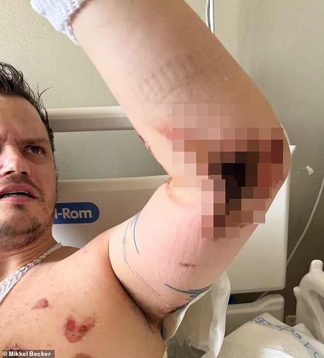 Ryan Battles Rare and Aggressive Pyoderma Gangrenosum as Family Seeks Expert Medical Advice