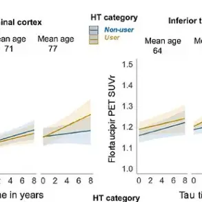 Study Links Late-Life Hormone Replacement Therapy to Increased Alzheimer's Risk