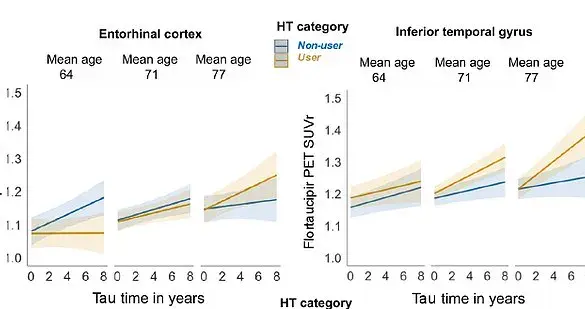 Study Links Late-Life Hormone Replacement Therapy to Increased Alzheimer's Risk