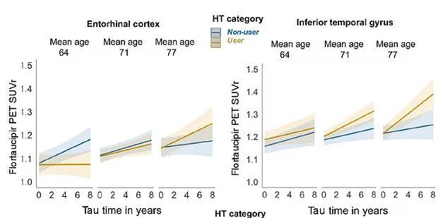 Study Links Late-Life Hormone Replacement Therapy to Increased Alzheimer's Risk