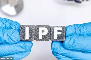 Cancer Drug Shows Promise in Treating Idiopathic Pulmonary Fibrosis