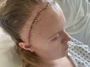 From GCSEs to Chemotherapy: A Teen's Journey With Stage 4 Hodgkin Lymphoma