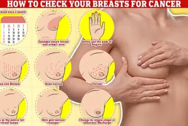 Glamour Model Claims Boob Job Led to Early Detection of Deadly Breast Cancer