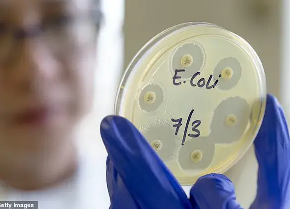 Sharp Rise in Deadly E.coli Strain Linked to Colon Cancer Epidemic Among Younger Adults
