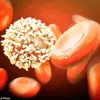Statins May Reduce Risk of Chronic Lymphocytic Leukemia: Preliminary Study Suggests