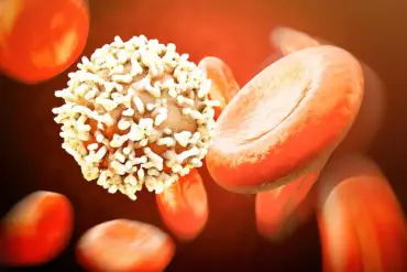 Statins May Reduce Risk of Chronic Lymphocytic Leukemia: Preliminary Study Suggests