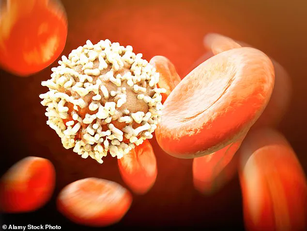 Statins May Reduce Risk of Chronic Lymphocytic Leukemia: Preliminary Study Suggests