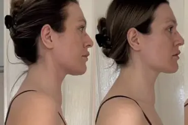 Young Woman's Cancer Warning: Dismissing Symptoms Led to Deadly Diagnosis