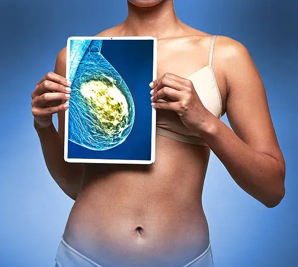 Experts Weigh In on NHS Proposal to Allow Male Workers in Breast Screenings, Sparking Debate Over Trust and Safety