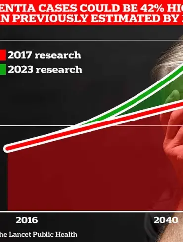 New Study Reveals Varicose Veins Linked to 23.5% Higher Dementia Risk, Urging Expert Advisories on Vascular Health
