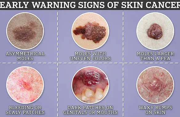 NHS Rolls Out Rapid Cancer 'Super Jab' for Thousands of Patients