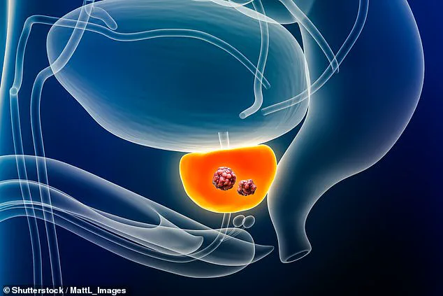 Revolutionary AI Test Developed by Artera Inc Identifies Prostate Cancer Biomarker, Paving the Way for New Treatment Approaches