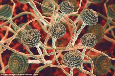 UK Health Officials Warn of Deadly Fungus C. auris: Rising Resistance and Public Health Threats Demand Urgent Action