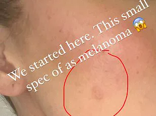 Unexpected Health Effects of Red Wine Prompt Expert Warnings and Public Health Considerations