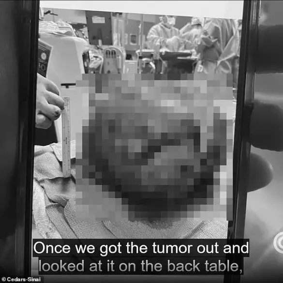 Ariana Pulido's Extraordinary Medical Battle: A Journey Through Unprecedented Complications and Resilience