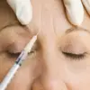 Government Issues Health Alert Over Unlicensed Botox-like Product Linked to 40 Cases of Adverse Reactions