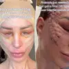 Grandmother's £10,000 Facial Transformation Captivates Online Audience