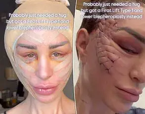 Grandmother's £10,000 Facial Transformation Captivates Online Audience