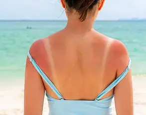 Health Experts Warn Against Fringe Theory Promoting UV Exposure as Beneficial, Contradicting Medical Consensus