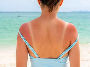 Health Experts Warn Against Fringe Theory Promoting UV Exposure as Beneficial, Contradicting Medical Consensus