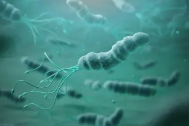 Helicobacter pylori Identified as Major Cause of Stomach Cancer, Experts Warn of Growing Global Impact