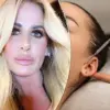 Influencer's Botched Boob Job Sparks Warnings About Cosmetic Surgery Risks for Social Media Followers