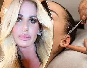 Influencer's Botched Boob Job Sparks Warnings About Cosmetic Surgery Risks for Social Media Followers