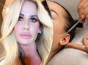 Influencer's Botched Boob Job Sparks Warnings About Cosmetic Surgery Risks for Social Media Followers