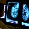 Mounjaro: Obesity Drug May Hold Key to Reducing Breast Cancer Risk, Study Suggests
