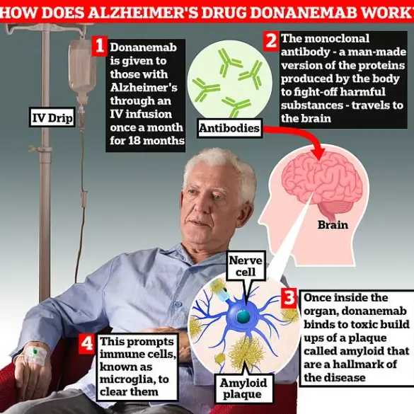 New Alzheimer's Drug Shows Promise in Halting Dementia Progression, Raising Hope for Millions