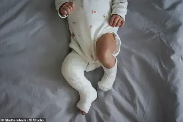 Study Suggests Potential Link Between Planned Caesarean Sections and Increased Risk of Acute Lymphoblastic Leukaemia in Children