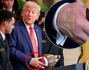 Unusual Patch on President Trump's Hand Sparks Speculation During White House Press Gaggle, Experts Analyze