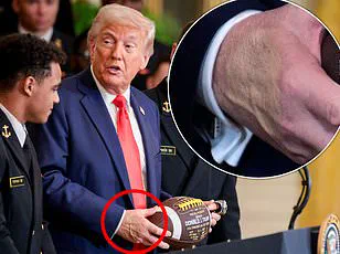 Unusual Patch on President Trump's Hand Sparks Speculation During White House Press Gaggle, Experts Analyze