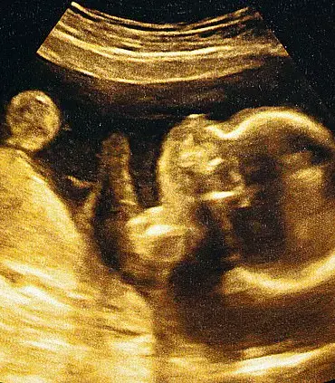 AI's 95% Accuracy in Predicting Birth Dates Challenges Traditional Methods, Says University of Kentucky Researchers