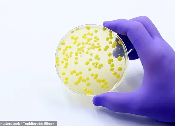 Rising Community MRSA Infections Spur Calls for Public Precautions, UKHSA Data Reveals 47% Increase