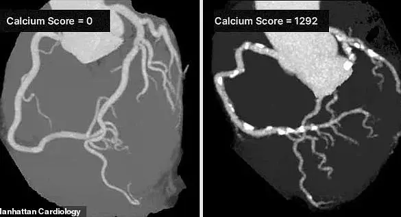 Silent Threat: Overlooked Heart Risks and the Urgent Need for Expert Guidance