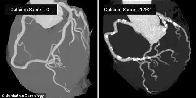Silent Threat: Overlooked Heart Risks and the Urgent Need for Expert Guidance