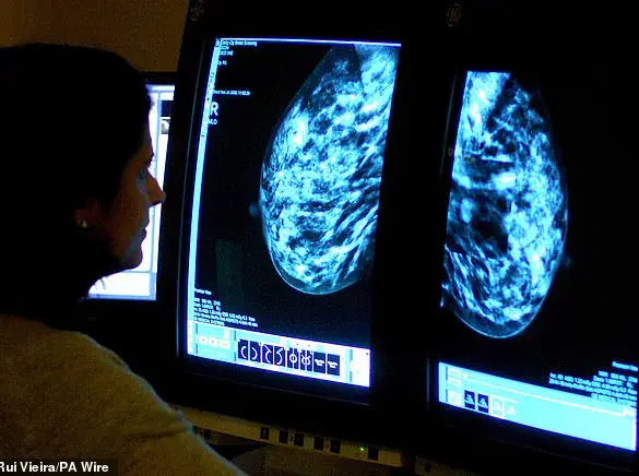Stephanie Weeks' Controversial Claims on Lifestyle Factors and Breast Cancer Spark Debate Among Medical Experts