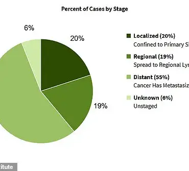 Expert Warns on Ovarian Cancer Symptoms: Early Detection Crucial for Public Health