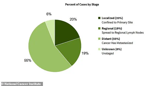 Expert Warns on Ovarian Cancer Symptoms: Early Detection Crucial for Public Health